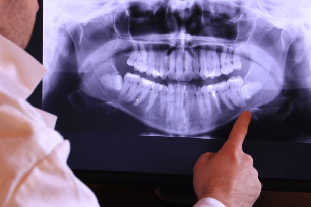 Best Emergency Tooth Extraction  in Merrydale, LA