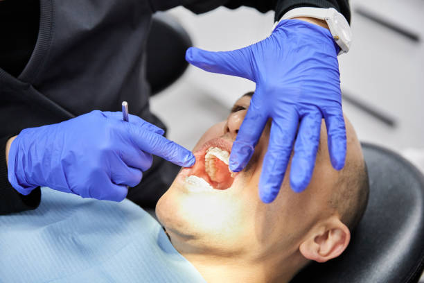 Best Emergency Dental Filling Replacement  in Merrydale, LA